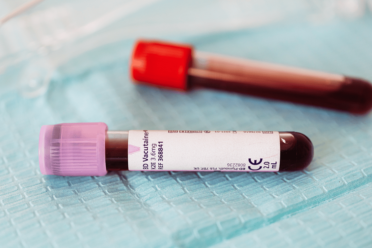 closeup of two blood vials