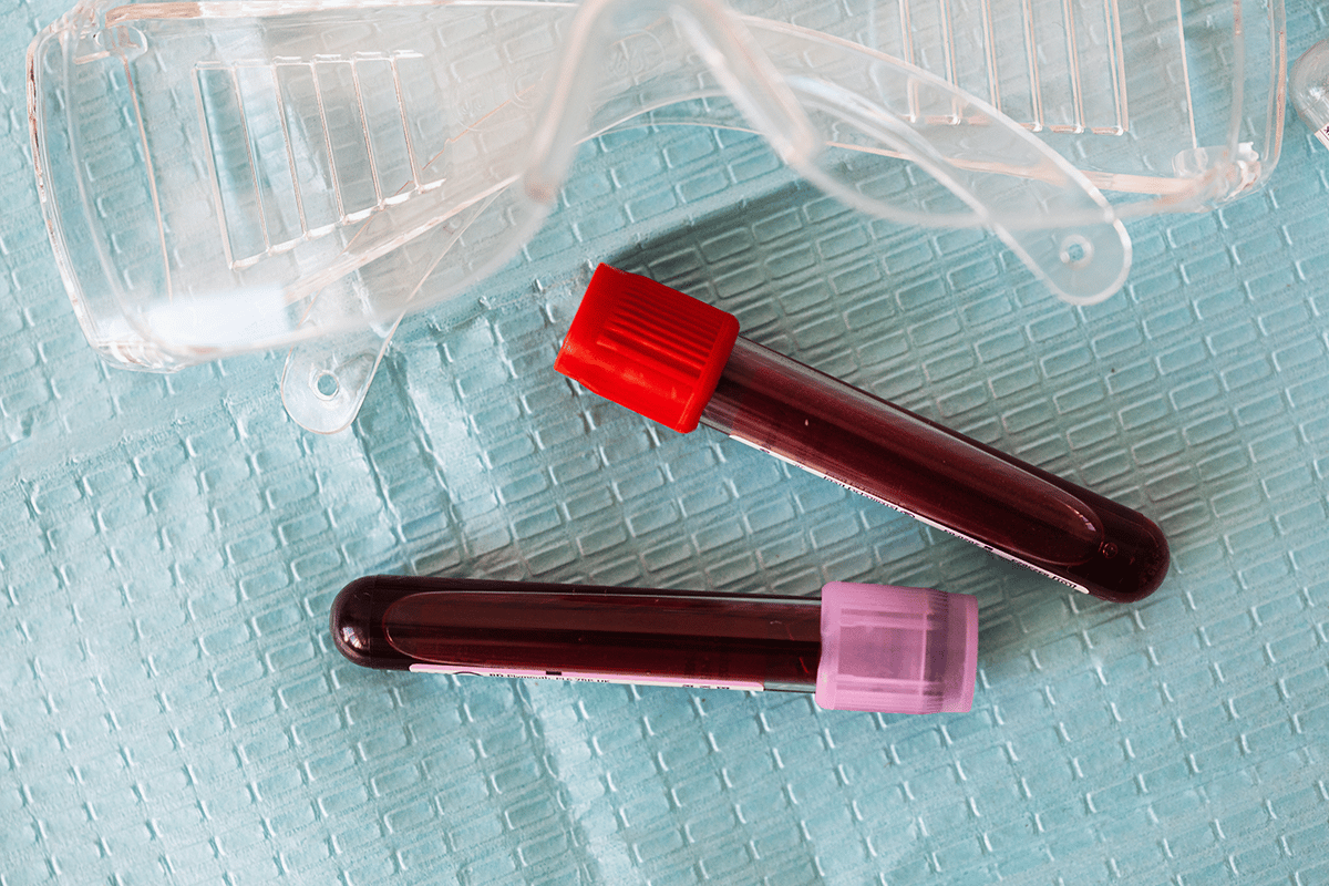 two vials of blood