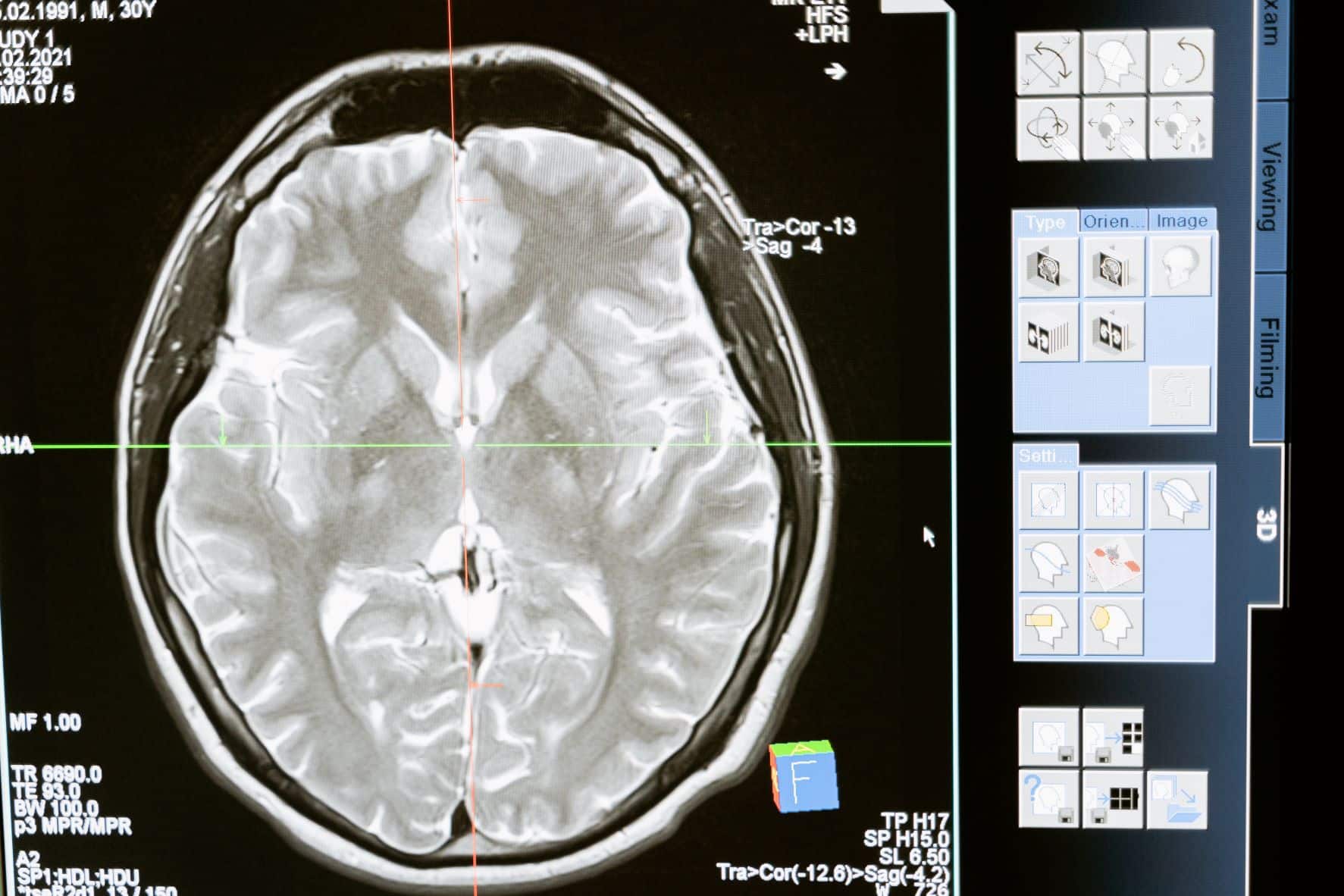 brain imaging scans
